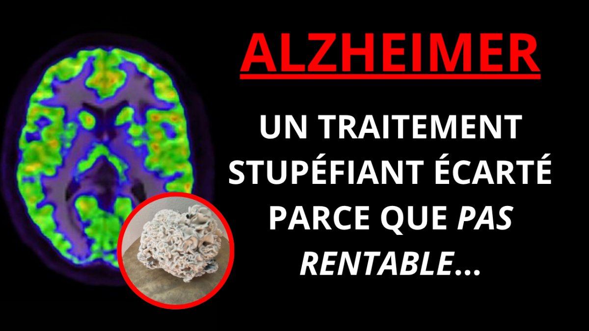 ALZHEIMER : LES VRAIS TRAITEMENTS NE SONT PAS FINANCÉS