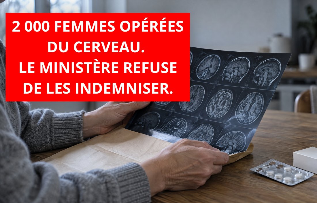 Plus de 2 000 femmes opérées d’une tumeur au cerveau : pour créer un fonds pour les victimes des progestatifs !